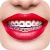 Braces Photo Editor