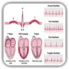 ECG / EKG Rhythm Step-by-Step Interpretation