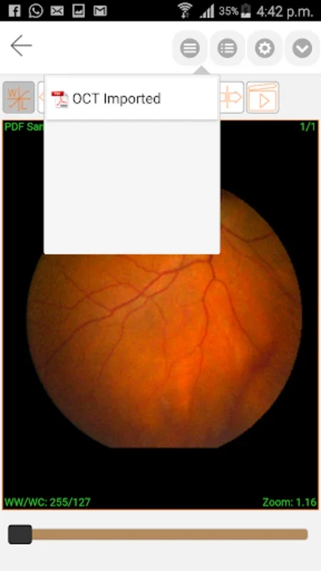 iPaxera for Android: Seamless PACS and DICOM Image Viewing