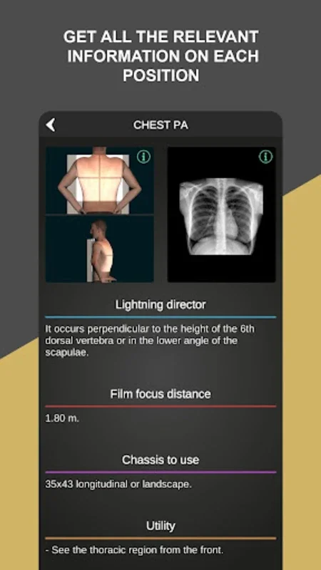 RX - Radiographic Positioning for Android: Enhance Skills