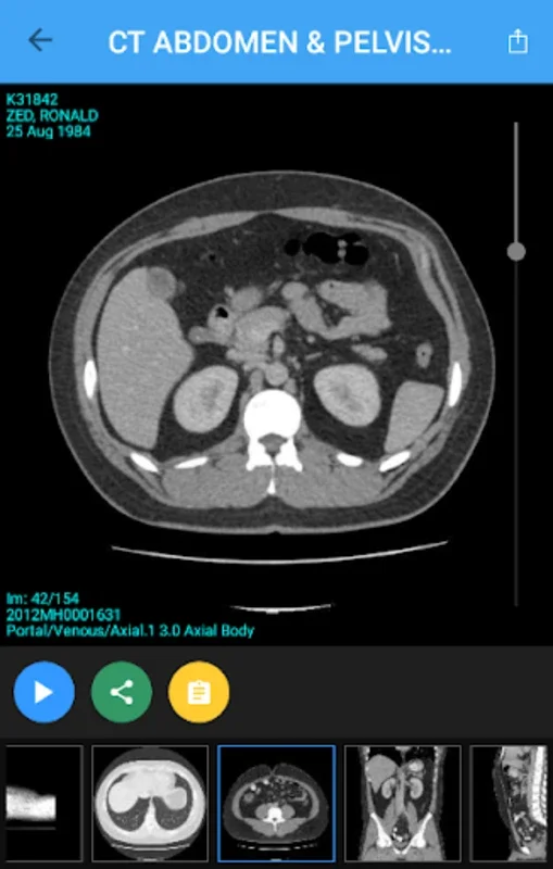 My Xrays – Quantum Patients for Android: Secure Medical Imaging Access