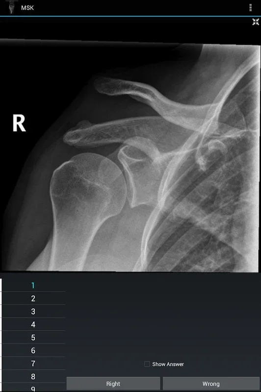 Radiology Flashcards: Free for Android - Enhance Your Knowledge