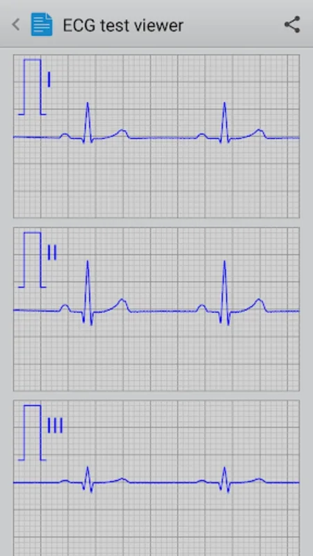 Istel ECG for Android: Efficient Heart Monitoring