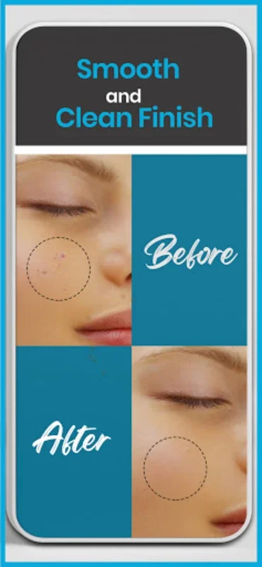 Blemish Editor Pimple Remover for Android: Achieve Flawless Portraits