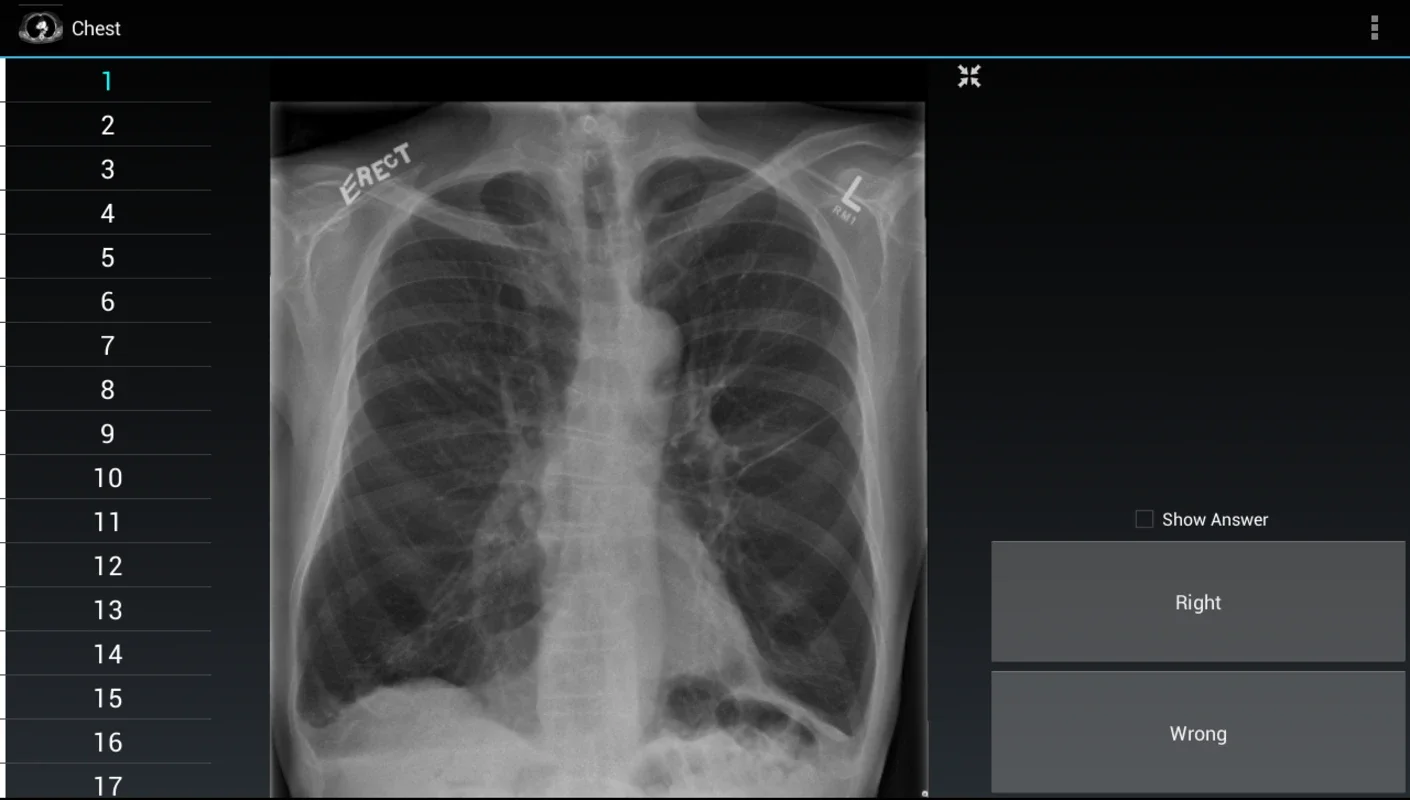 Radiology Flashcards: Free for Android - Enhance Your Knowledge