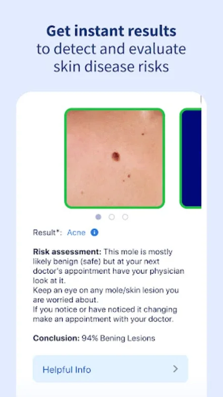 AI Dermatologist: Skin Scanner for Android - No Downloading Required