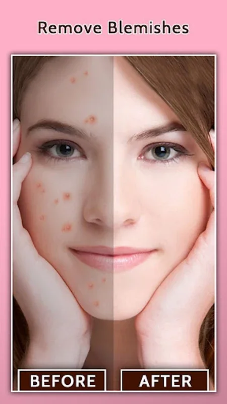 Face Blemish Remover for Android - Flawless Portraits Made Easy