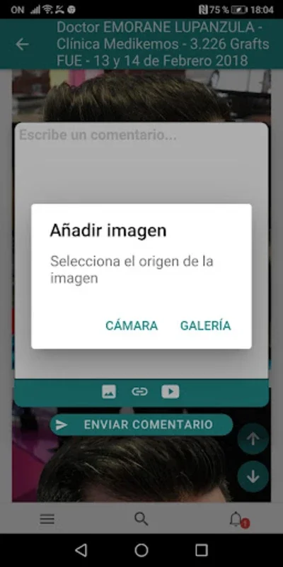 Injerto Capilar for Android - A Hair Restoration Hub