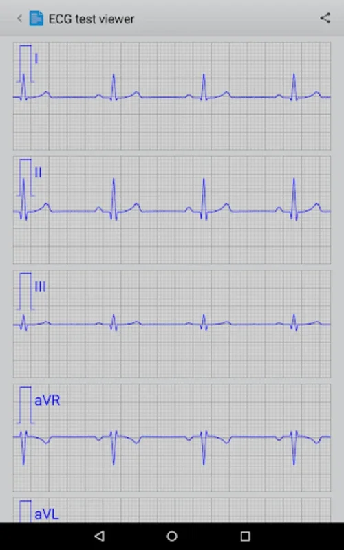 Istel ECG for Android: Efficient Heart Monitoring