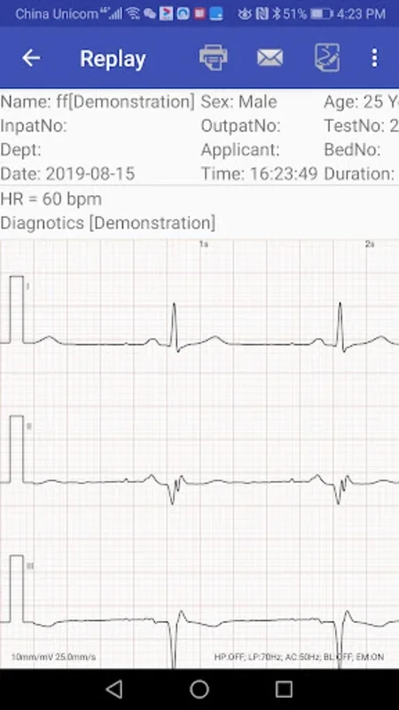 aECG for Android: Real-Time ECG Monitoring & Cloud Storage