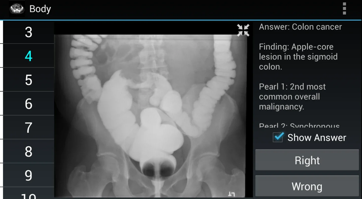 Radiology Flashcards: Free for Android - Enhance Your Knowledge