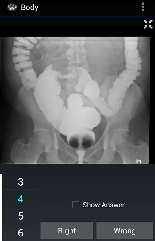 Radiology Flashcards: Free for Android - Enhance Your Knowledge