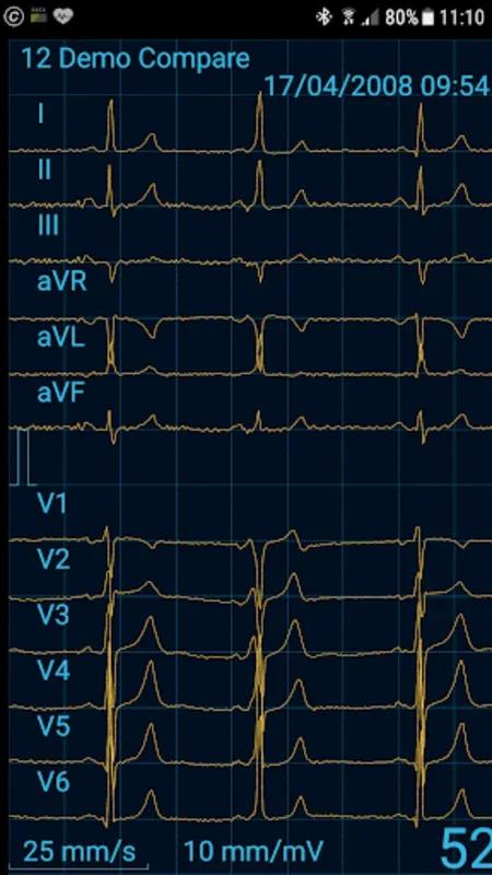 Cardiax for Android: Advanced Mobile ECG Monitoring