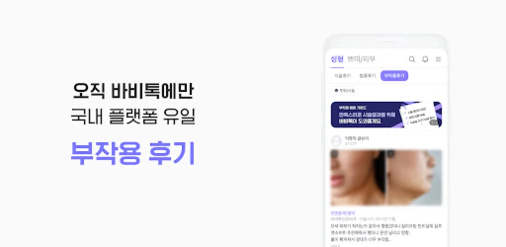 바비톡 for Android - Korea's Plastic Surgery App