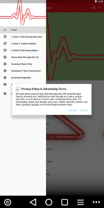 ECG / EKG Rhythm Step-by-Step Interpretation for Android