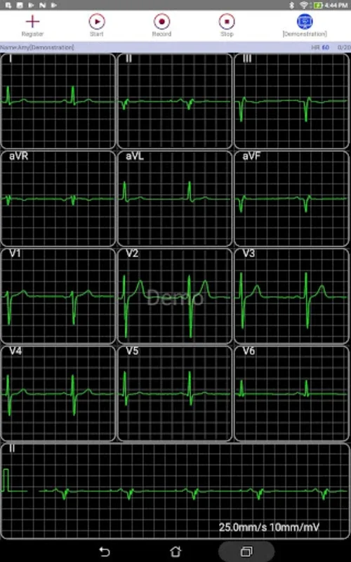 aECG for Android: Real-Time ECG Monitoring & Cloud Storage