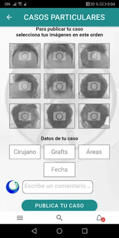 Injerto Capilar for Android - A Hair Restoration Hub