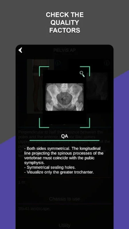 RX - Radiographic Positioning for Android: Enhance Skills