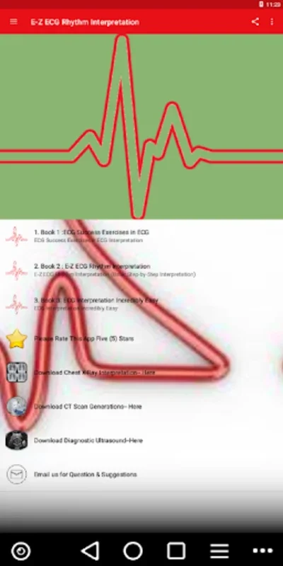 ECG / EKG Rhythm Step-by-Step Interpretation for Android