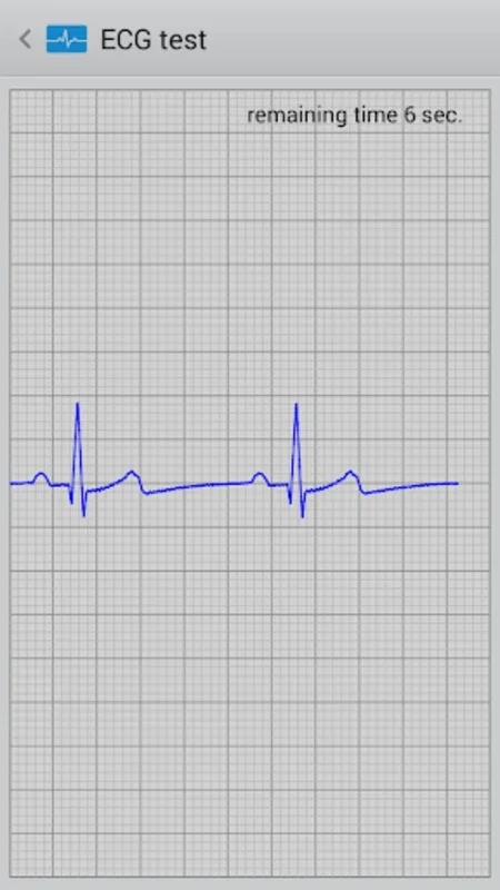 Istel ECG for Android: Efficient Heart Monitoring