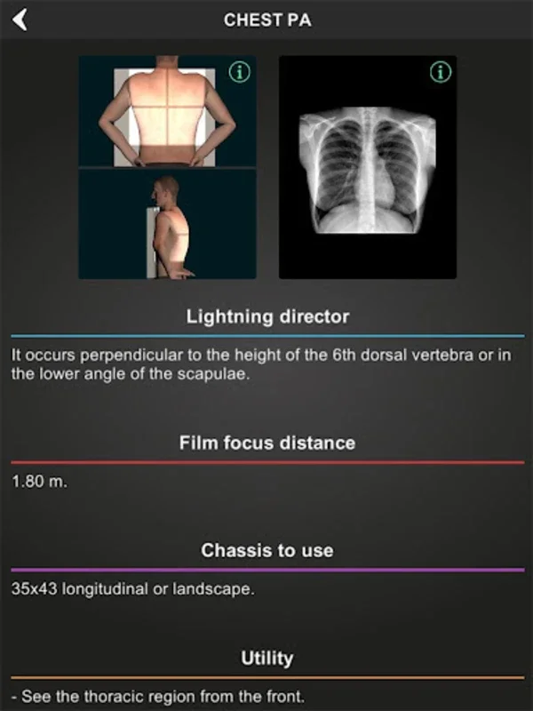 RX - Radiographic Positioning for Android: Enhance Skills