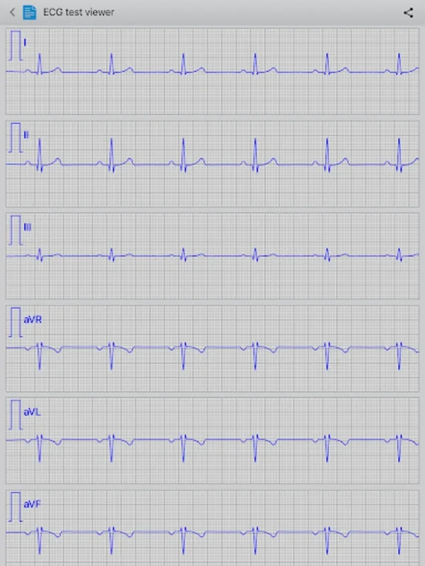 Istel ECG for Android: Efficient Heart Monitoring