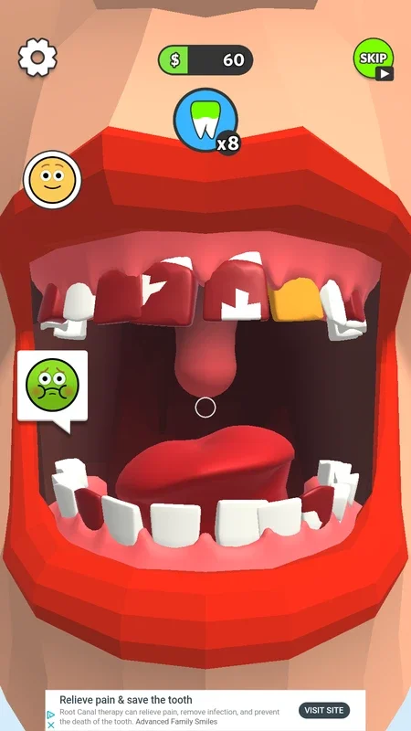 Dentist Bling for Android: A Fun Dental Care Simulation