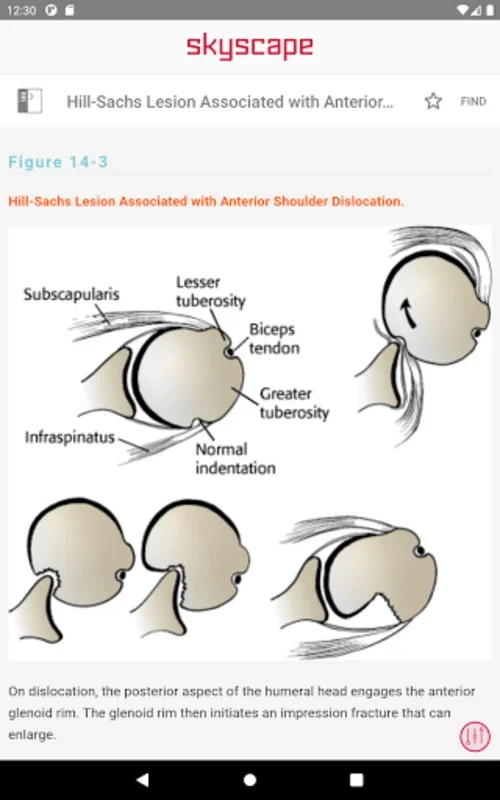 Handbook of Fractures for Android: Comprehensive Fracture Care