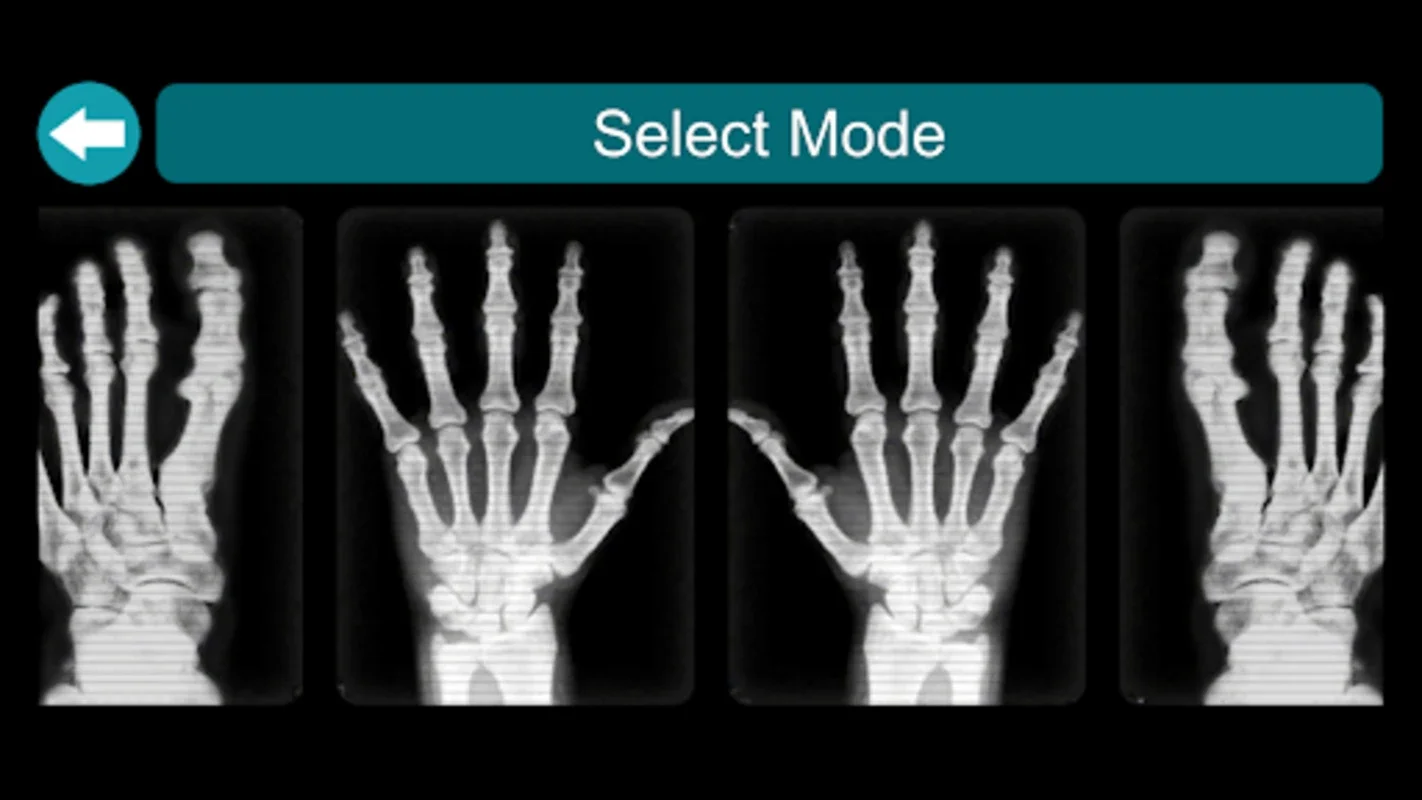 X-Ray Scanner for Android - Download the APK from AppHuts