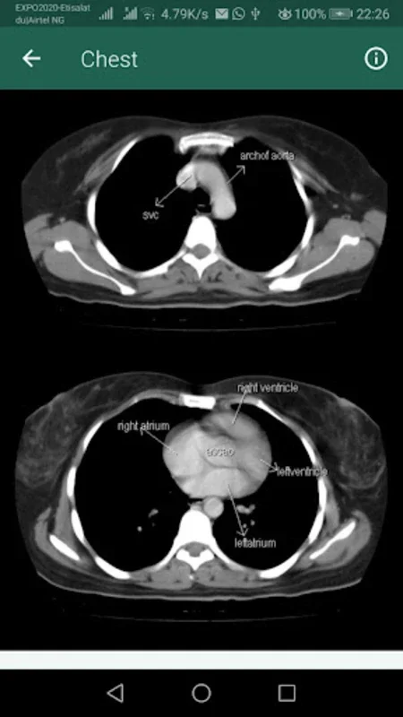 Ruky_CT Scan Anatomy for Android: Detailed Anatomy Insights