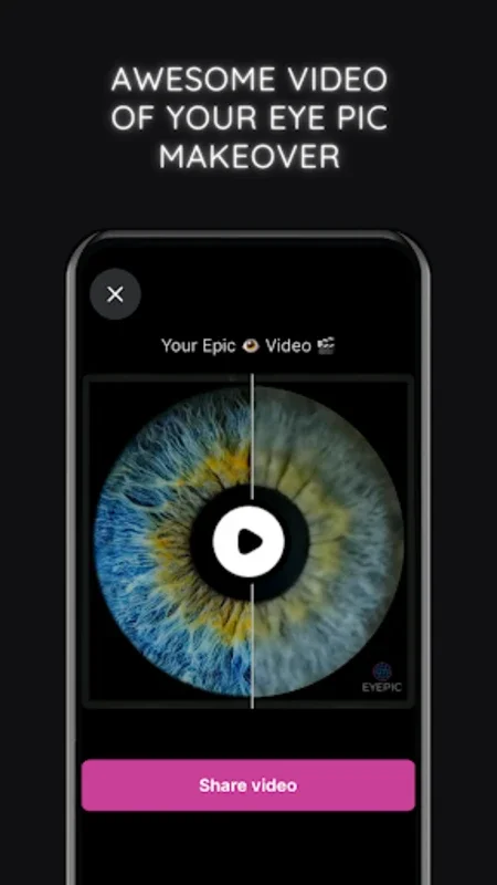 Eyepic for Android: Enhance Eye Photos with AI