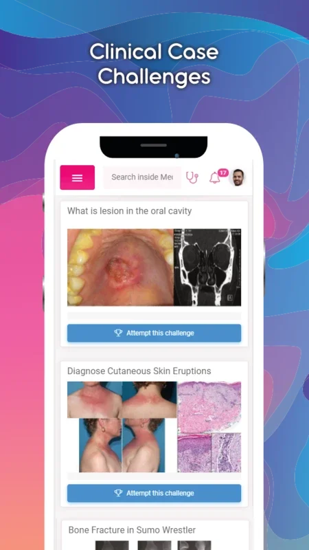 MedSynapse for Android: Revolutionizing Doctor Networking