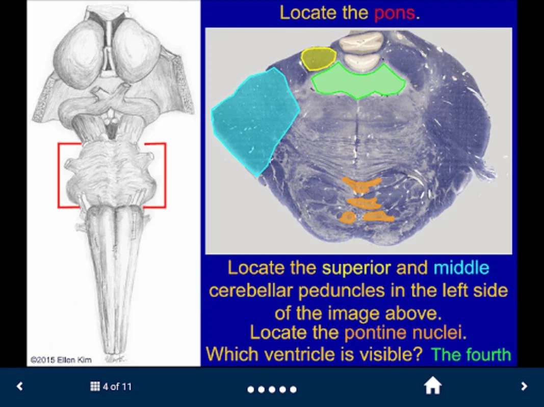 Neuroanatomy - SecondLook for Android: Master Neuroanatomy