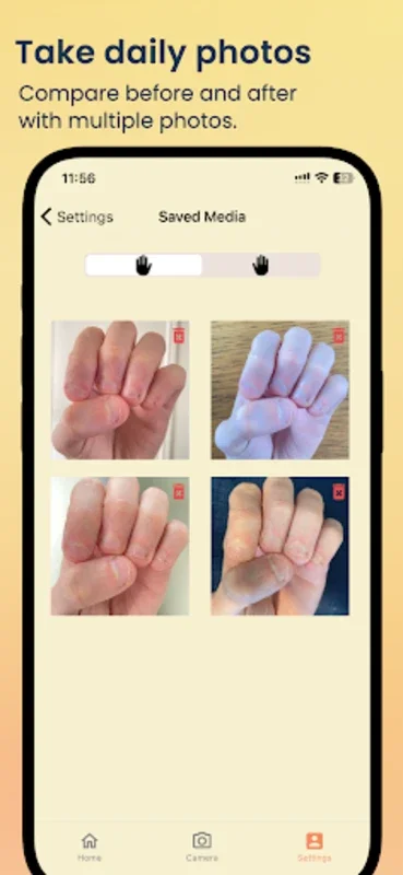 NailKeeper for Android - Promote Nail Health