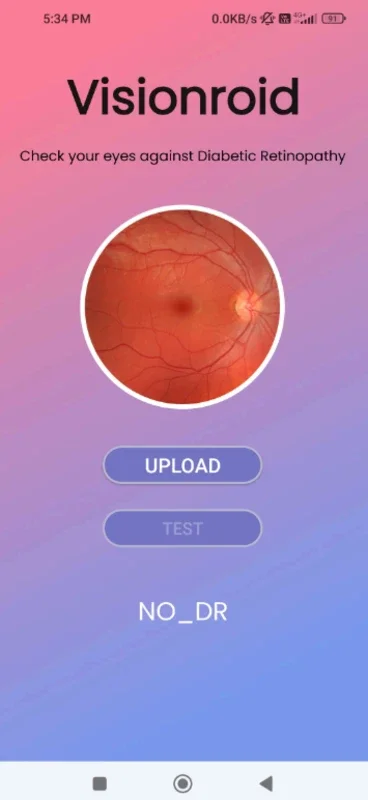 Visionroid for Android - Advanced Diabetic Retinopathy Detection