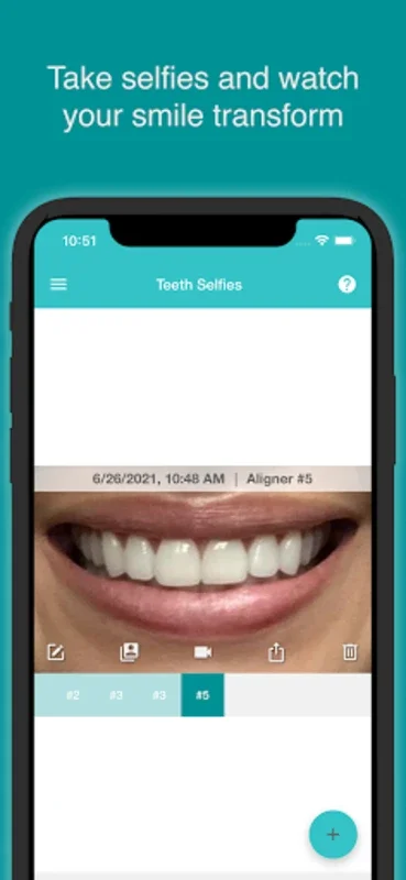 TrayMinder for Android - Manage Clear Aligner Treatment