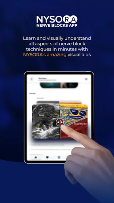 Nerve Blocks for Android - Advanced Anesthesia Learning App
