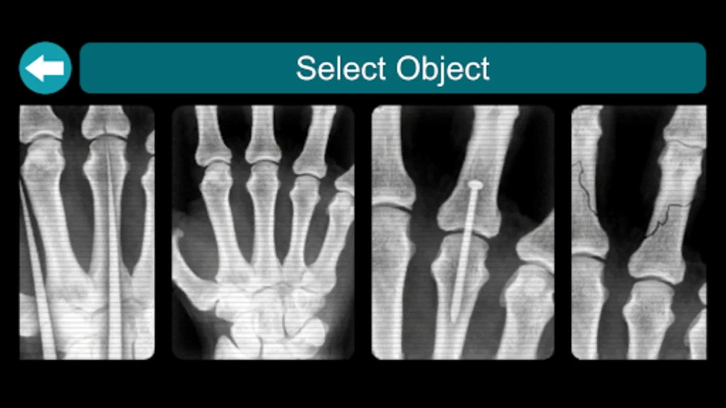 X-Ray Scanner for Android - Download the APK from AppHuts