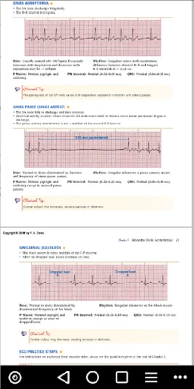 ECG / EKG Rhythm Step-by-Step Interpretation for Android